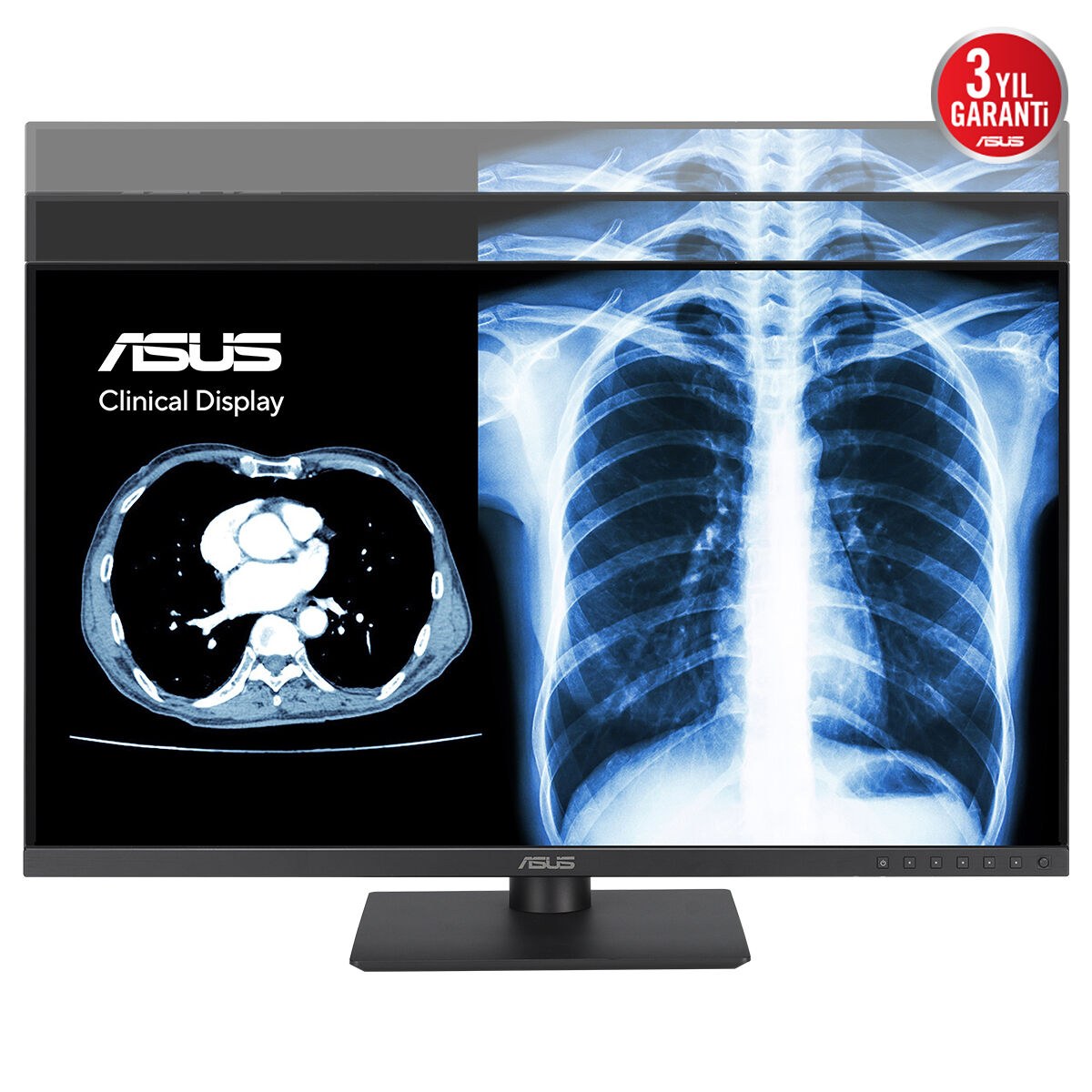 ASUS KLİNİK MONİTÖR MH2441A 23.8 IPS 3.6MP 2560x1440 5ms 75Hz 300cd DP HDMI USB-C YOK VESA 3YIL AGLR DICOM PART 14 GSDF DICOM ÖN AYARI OTOMATİK KALİBRASYON JND <%10 ANTİBAKTERİYAL KAPLAMA DAISY CHAIN - 4