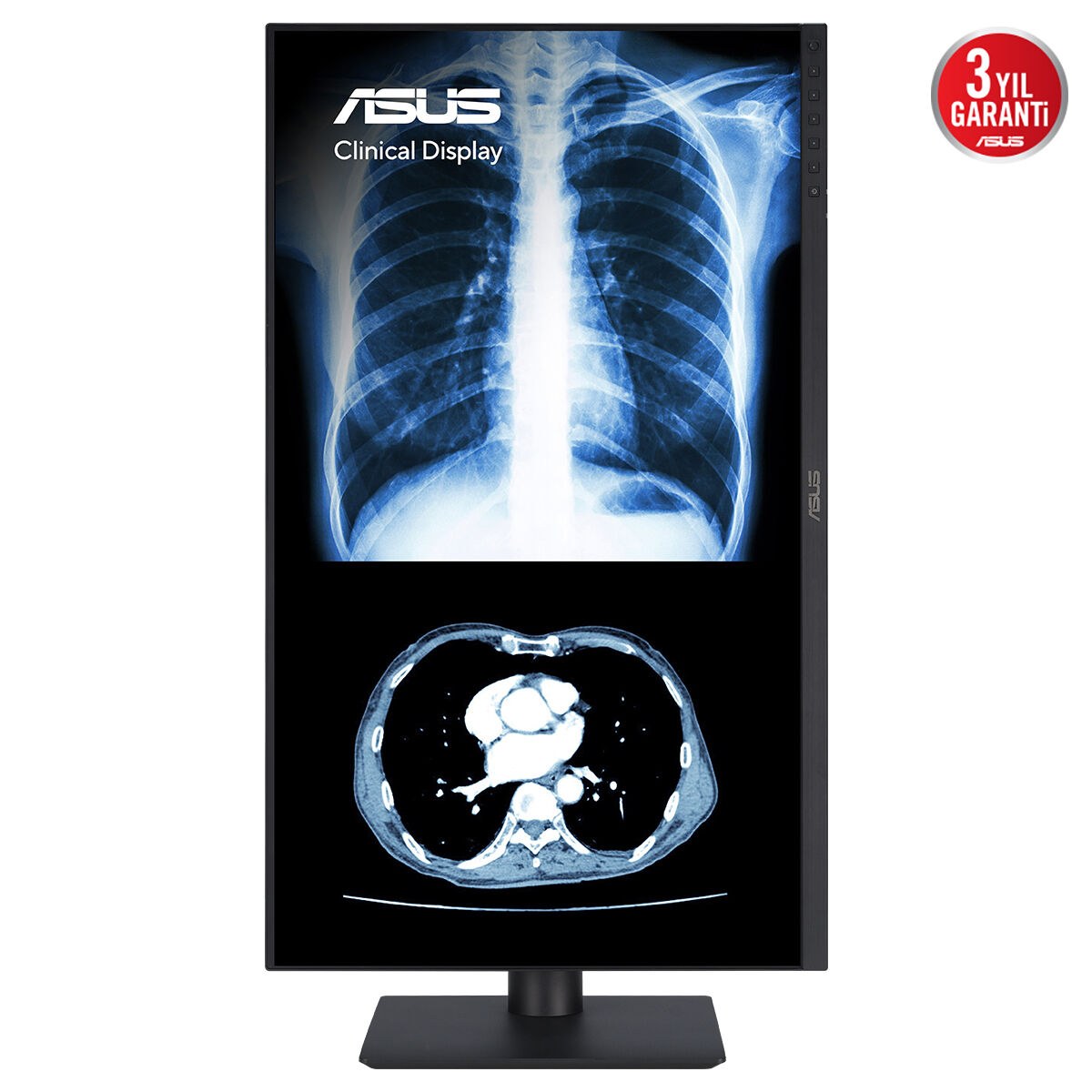 ASUS KLİNİK MONİTÖR MH2741A 27 IPS 3.6MP 2560x1440 5ms 75Hz 350cd DP HDMI USB-C YOK VESA 3YIL AGLR DICOM PART 14 GSDF DICOM ÖN AYARI OTOMATİK KALİBRASYON JND <%10 ANTİBAKTERİYAL KAPLAMA DAISY CHAIN - 5